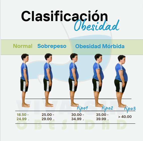 Tipos Obesidad